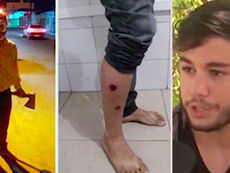 Jovem se veste de palhaço macabro e leva balas de borracha da PM
