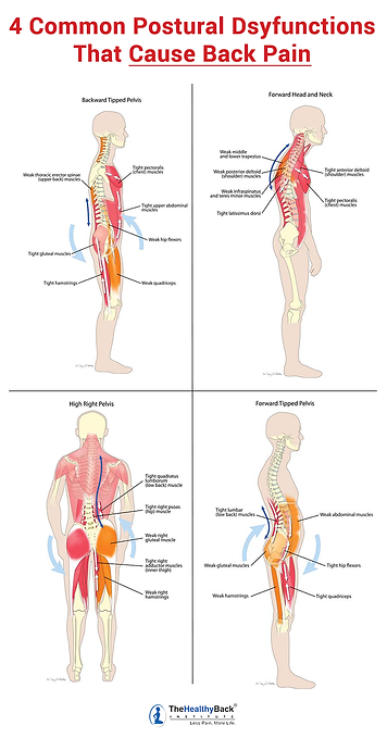 17 Muscles That Cause the MOST Back Pain