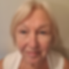 After picture of the same 78 year old woman with faded sun spots and even skin tone.