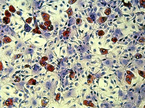 adipocytes unipv_edited.jpg