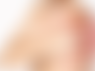 ROTURA DE MANGUITO ROTADOR