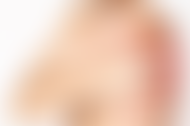 ROTURA DE MANGUITO ROTADOR