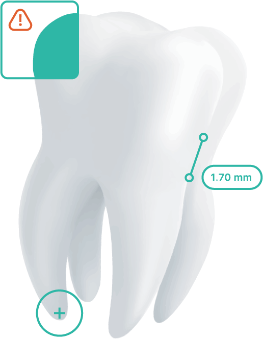 Adravision AI Dental XRay Diagnostics Software