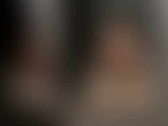 Indian working woman looking in a mirror checking dark circles and under-eye hollows, illustrating the need for professional dermatological treatment