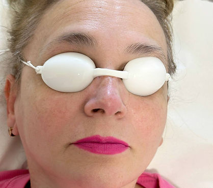 IPL Skin Rejuvenation