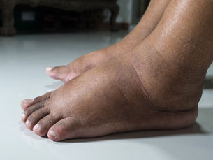 The Never War On Sugar - Diabetes