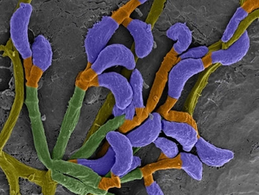 Perspectiva del autor sobre "Bioinspiración a partir de Pseudogymnoascus destructans": Avances en el diseño terapéutico mediante señalización ambiental y remodelación adaptativa del proteoma.