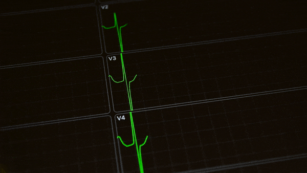 ezgif.com-gif-maker (1).gif