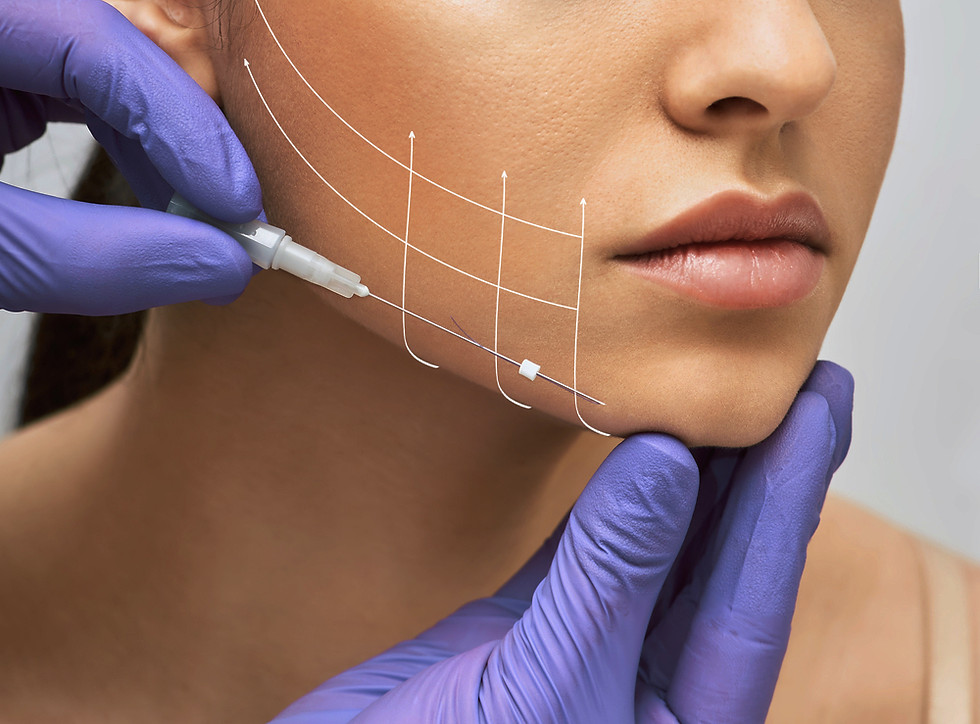 thread lift_edited.jpg