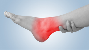 Біль після травми: коли це просто забій, а коли перелом?