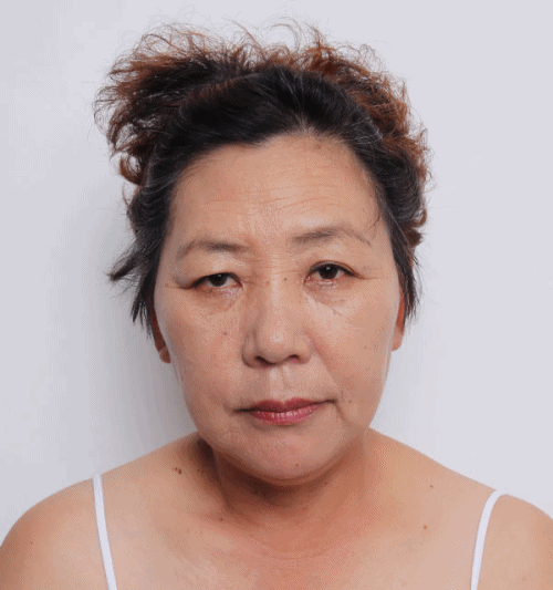Middle-aged woman with curly hair against a plain background. before and after photo about lifting procedure