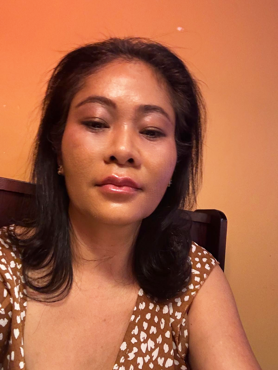 Before and after photos of facelift surgery in Seoul for anti-aging treatment