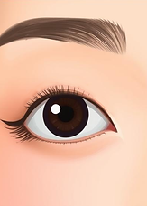 Illustrations showing the step-by-step procedures of eye surgery - before
