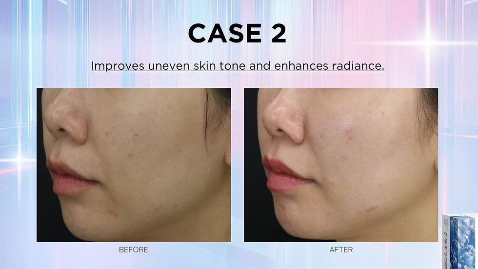 PROSTROLANE® Blanc B Before After 2 Elegance Clinic