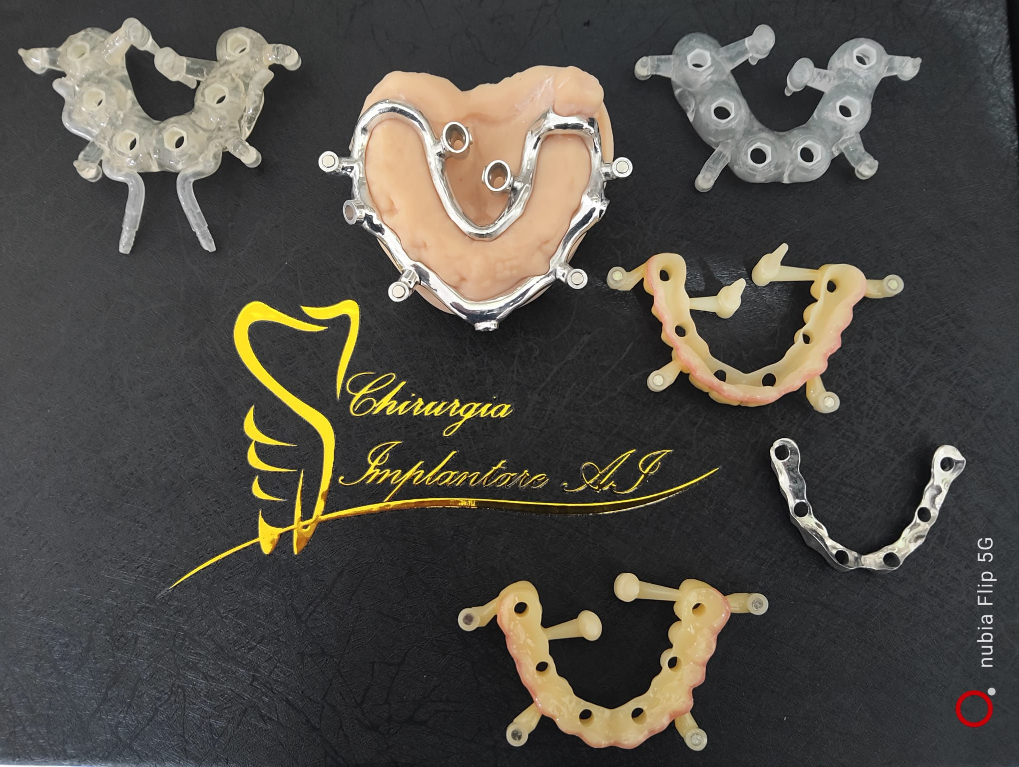 Chirurgia implantare con intelligenza artificiale