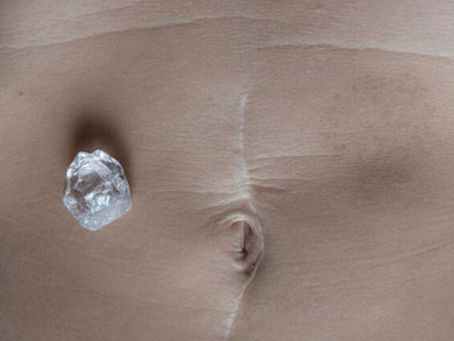 Cicatrices et fuites d’énergie : retrouver élan et vitalité