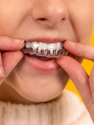 Want to Replace Your Braces with Clear Aligners? Consult an Invisalign Dentist