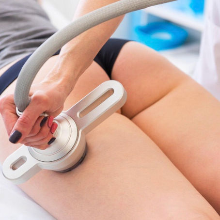 CoolSculpting Treatment: Non-Surgical Fat Reduction Explained