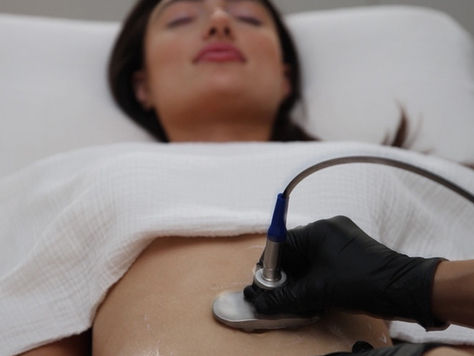 The Benefits of Indiba Treatment for Body Contouring