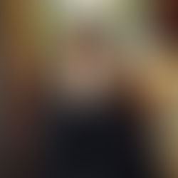 Does BOTOX® Help With Migraines?