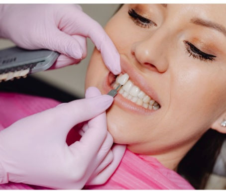 A Smile That Still Looks Like You: Considering Removable Veneers Before a Special Occasion