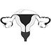 Endometriose