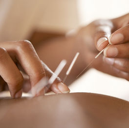 Boost Your Embryo Transfer Success with Acupuncture: Essential Timing Tips