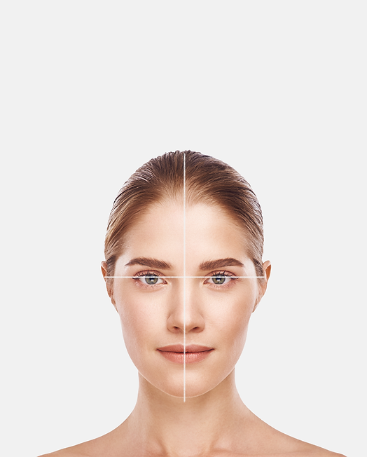 Filler injection site