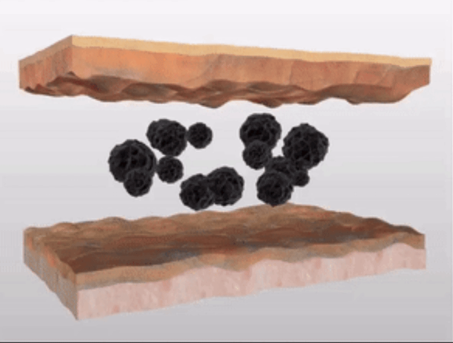 picosure lab clinic2.gif