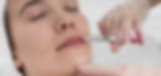 Lab clinic auckland filler injection