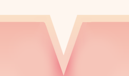 Scar V line Type