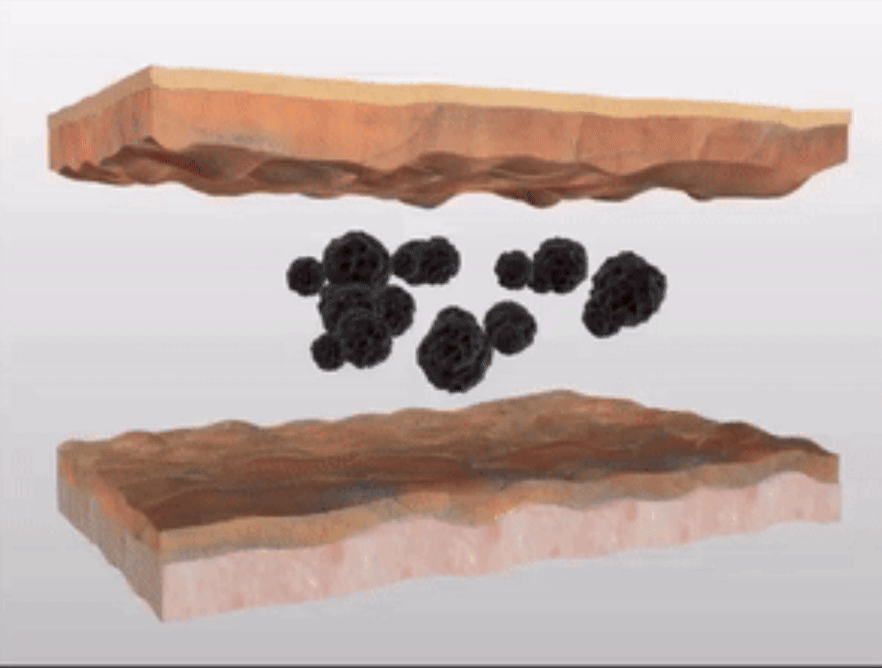 picosure lab clinic.gif