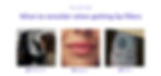 Lip filler what to consider