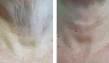 Jalupro neck.webp