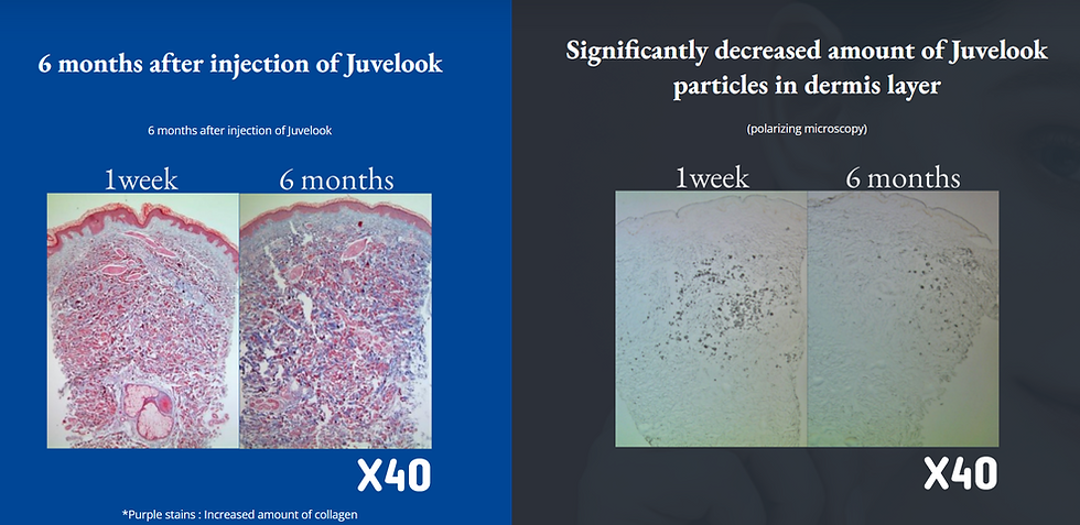 how juvelook works at the lab clinic Auckland