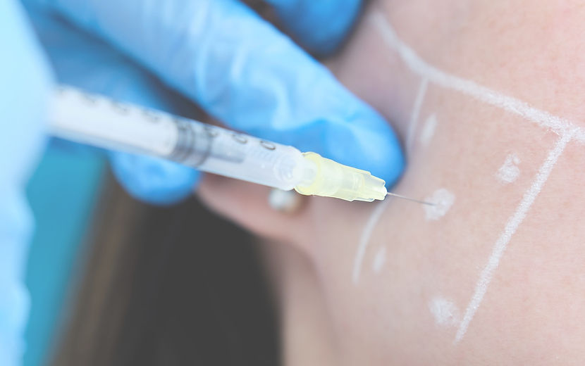 Skin booster injection At The Lab