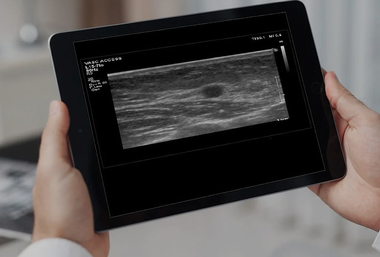 ultrasound at the lab auckland