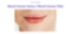 Mouth corner botox/mouth corner filler