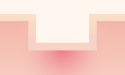 Scar Square type
