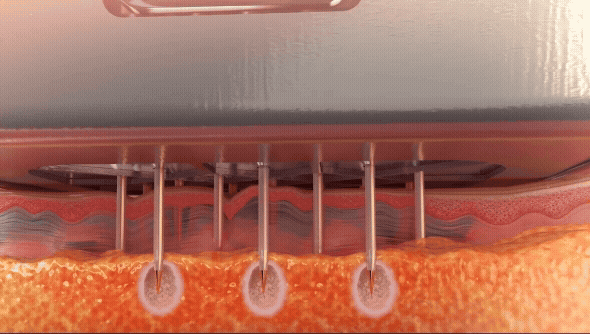 morpheus how it works 2.gif