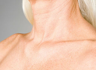 neck-decollete-rejuvenation_edited.jpg