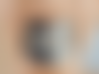 Boost Your Smile With Durable Dental Implants: Benefits of Dental Implants