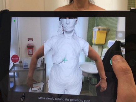 Scanner 3D Structure Sensor está transformando a cirurgia plástica e estética