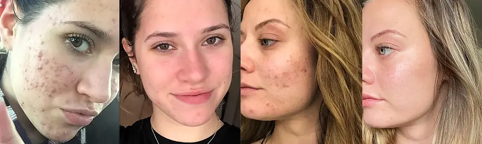 before-and-after-results