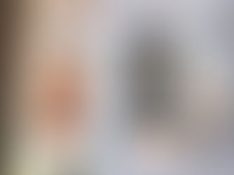 My Turkish Hair Transplant Experience