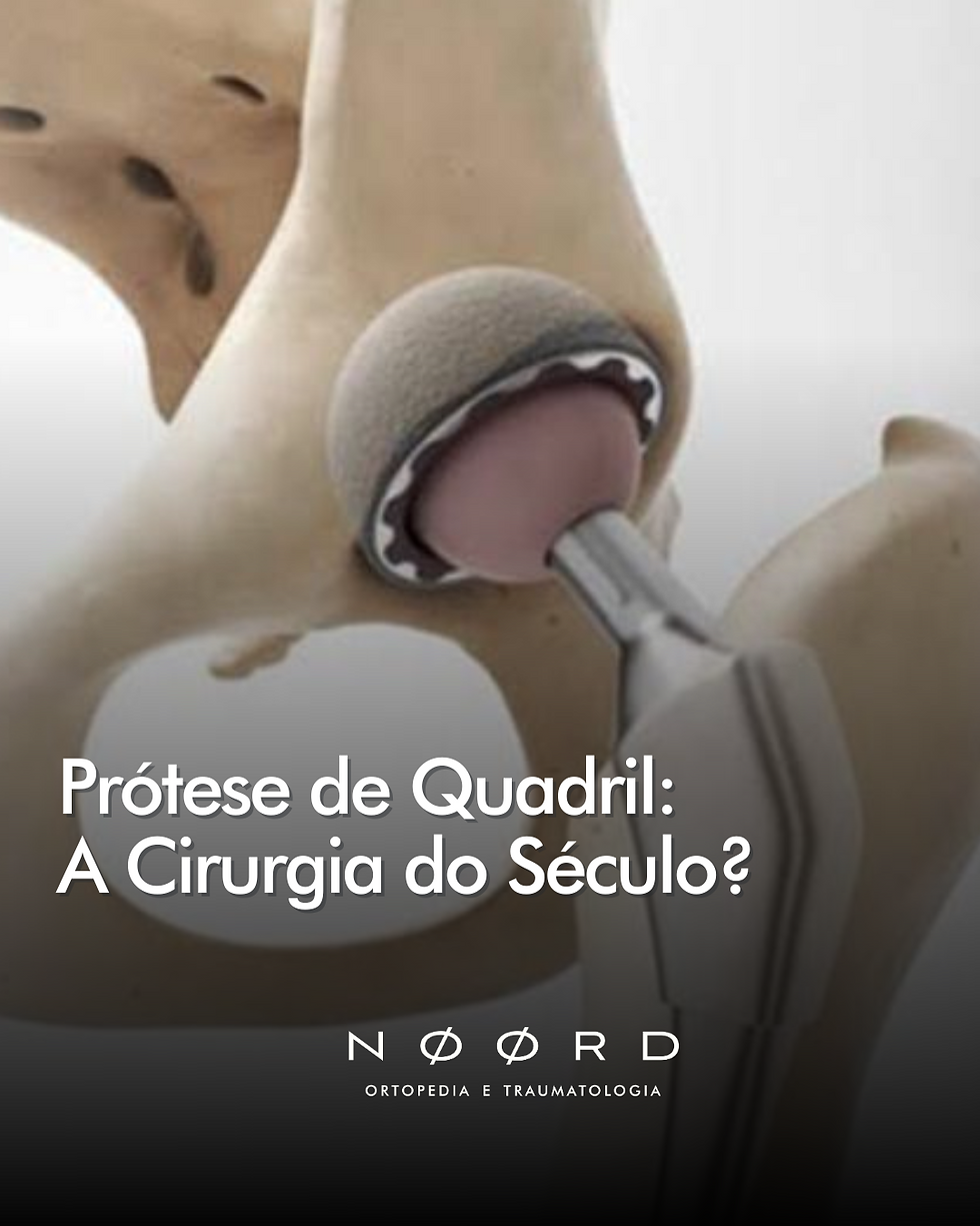 Prótese de quadril: a cirurgia do século?