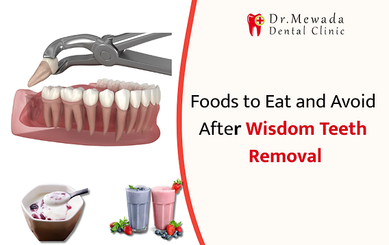 What to Eat (and Avoid) After Wisdom Teeth Removal