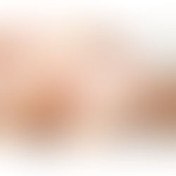 ビタミンC+A導入で肌を育てるフェイシャルケア