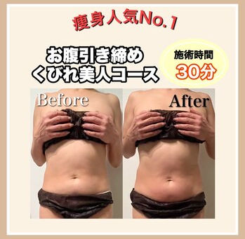 【限定クーポン】お腹引き締め~くびれ美人|キャンペーン