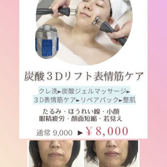 7月は満員御礼*炭酸3D表情筋ケアで「私も変われるかも?」を体感しませんか